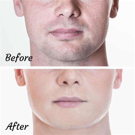 How to get rid of mustache shadow. Things To Know About How to get rid of mustache shadow. 